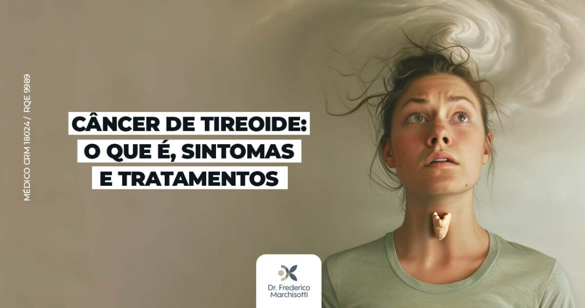 Câncer de Tireoide